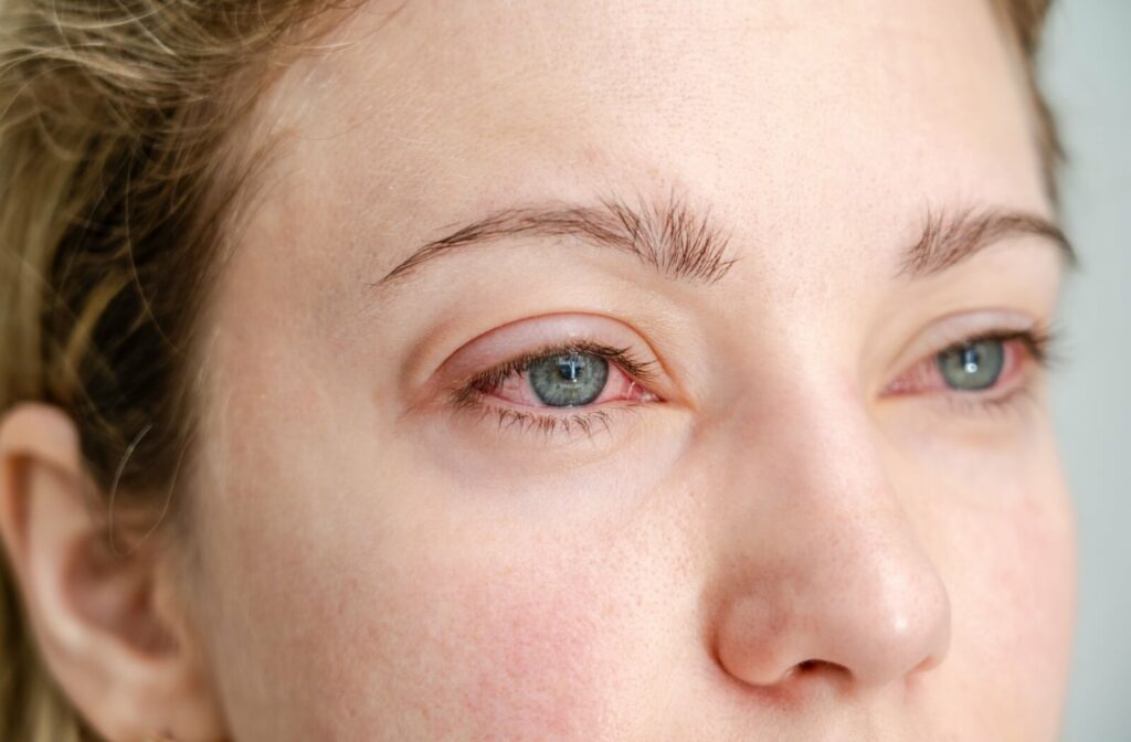 natural tear support eyelid gland health